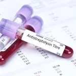 ASOT Kit (Anti-Streptolysin O)