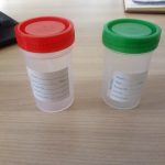 Stool Containers: 30ml screw-cap with spoon — various.